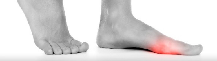 Painful Feet